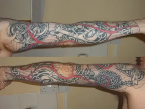 Jason - left arm