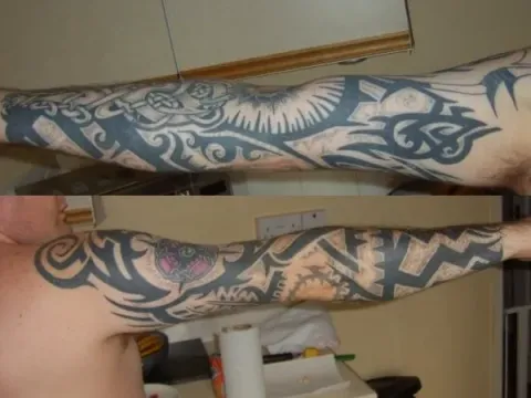 Jason - right arm